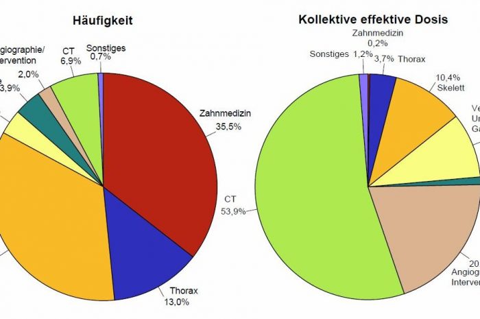 STAHLENBELASTUNG DURCH ZAHNMEDIZIN: 0,2%